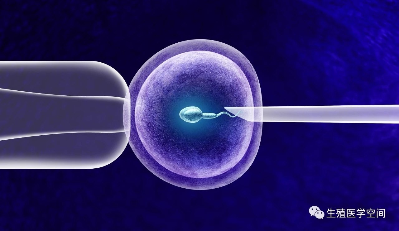 国内试管婴儿胚胎植入前遗传学诊断