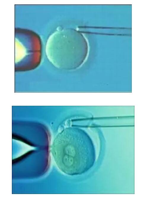 四川辅助生殖技术
