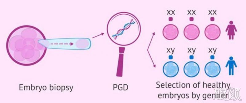 国外生子辅助生殖技术