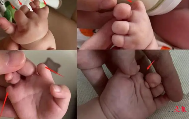 国内试管婴儿技术现状与发展趋势